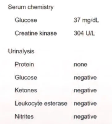 Usmle2 3